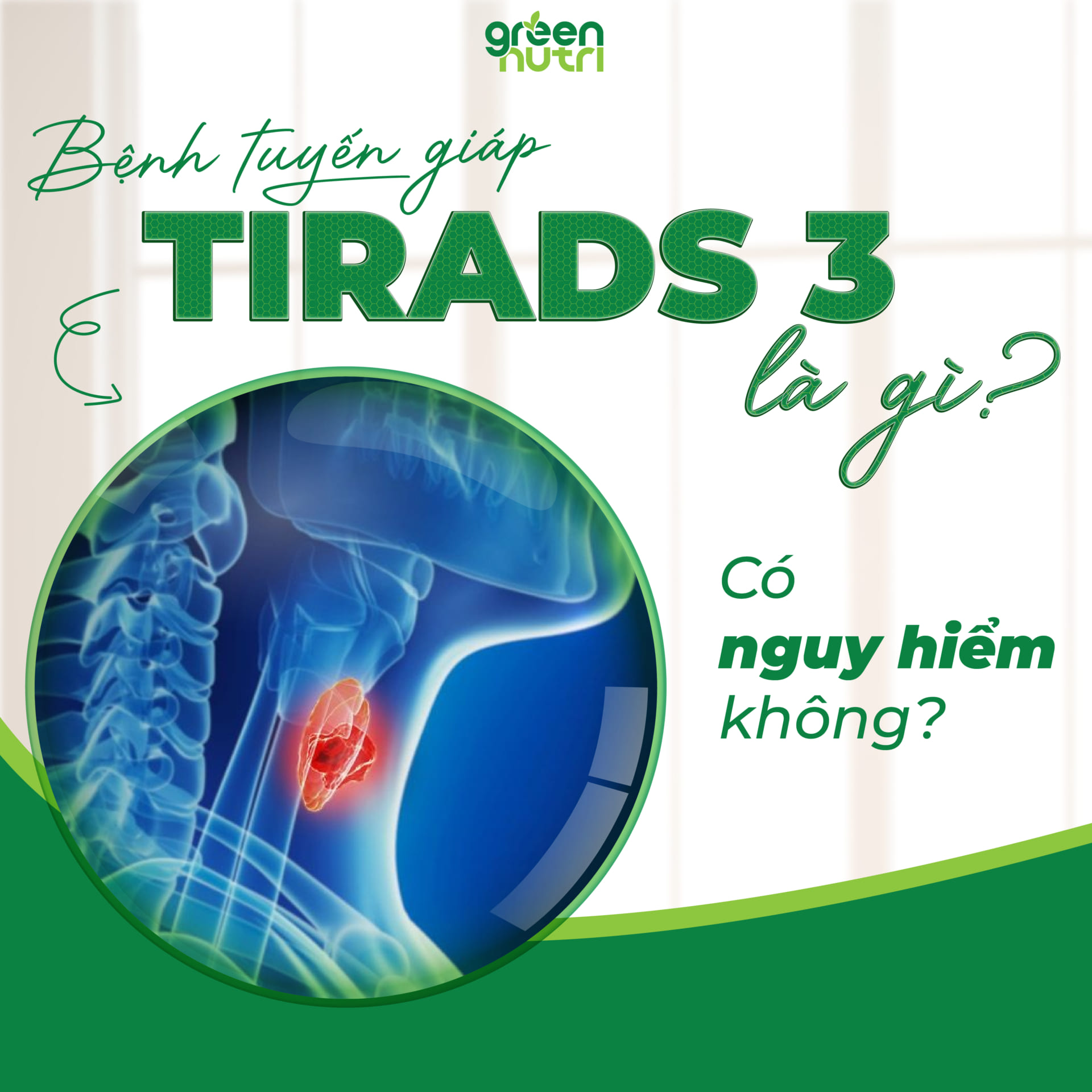 Bệnh tuyến giáp TIRADS 3 là gì có nguy hiểm không?