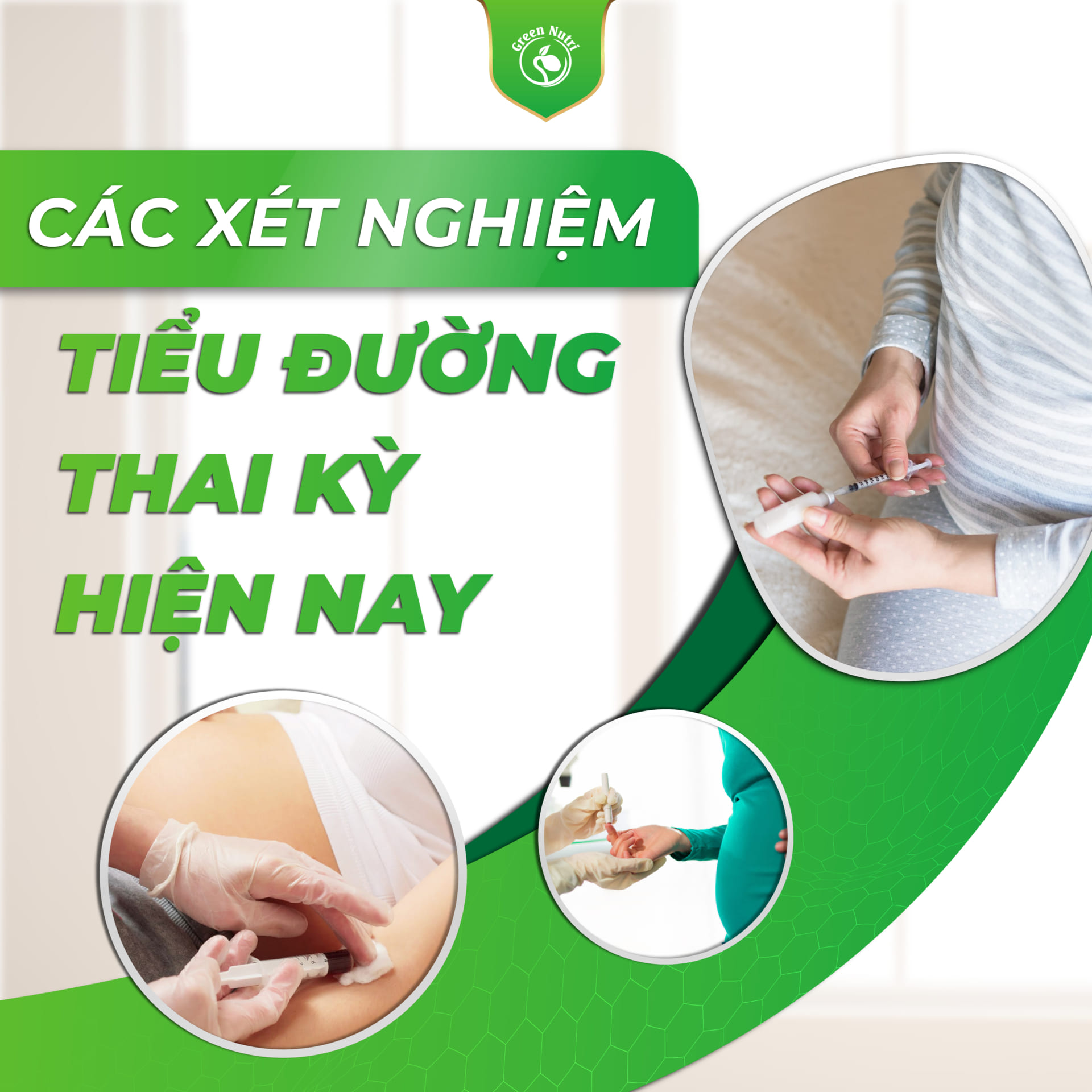 Thời điểm xét nghiệm tiểu đường thai kỳ tốt nhất