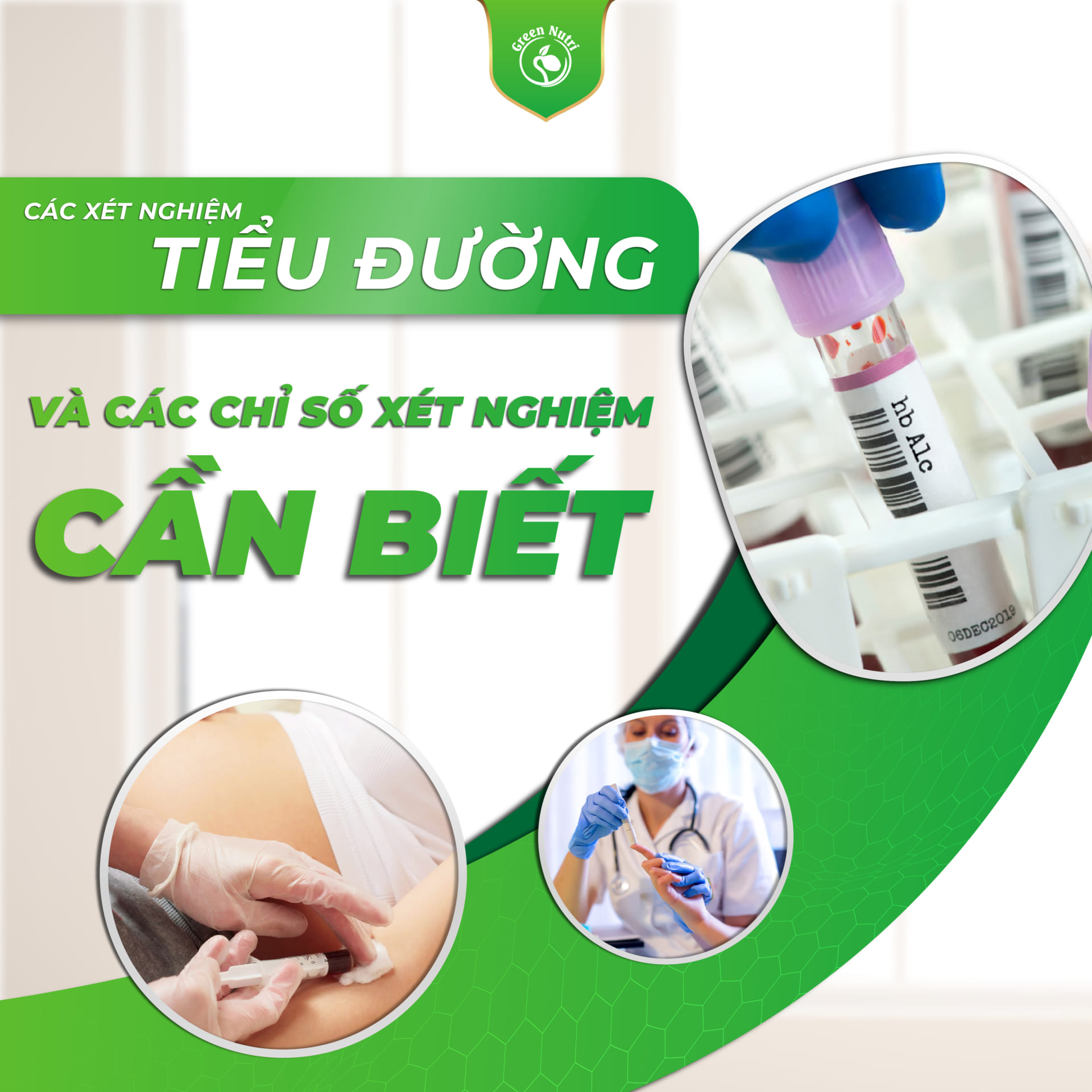 Xét nghiệm tiểu đường cho mọi lứa tuổi