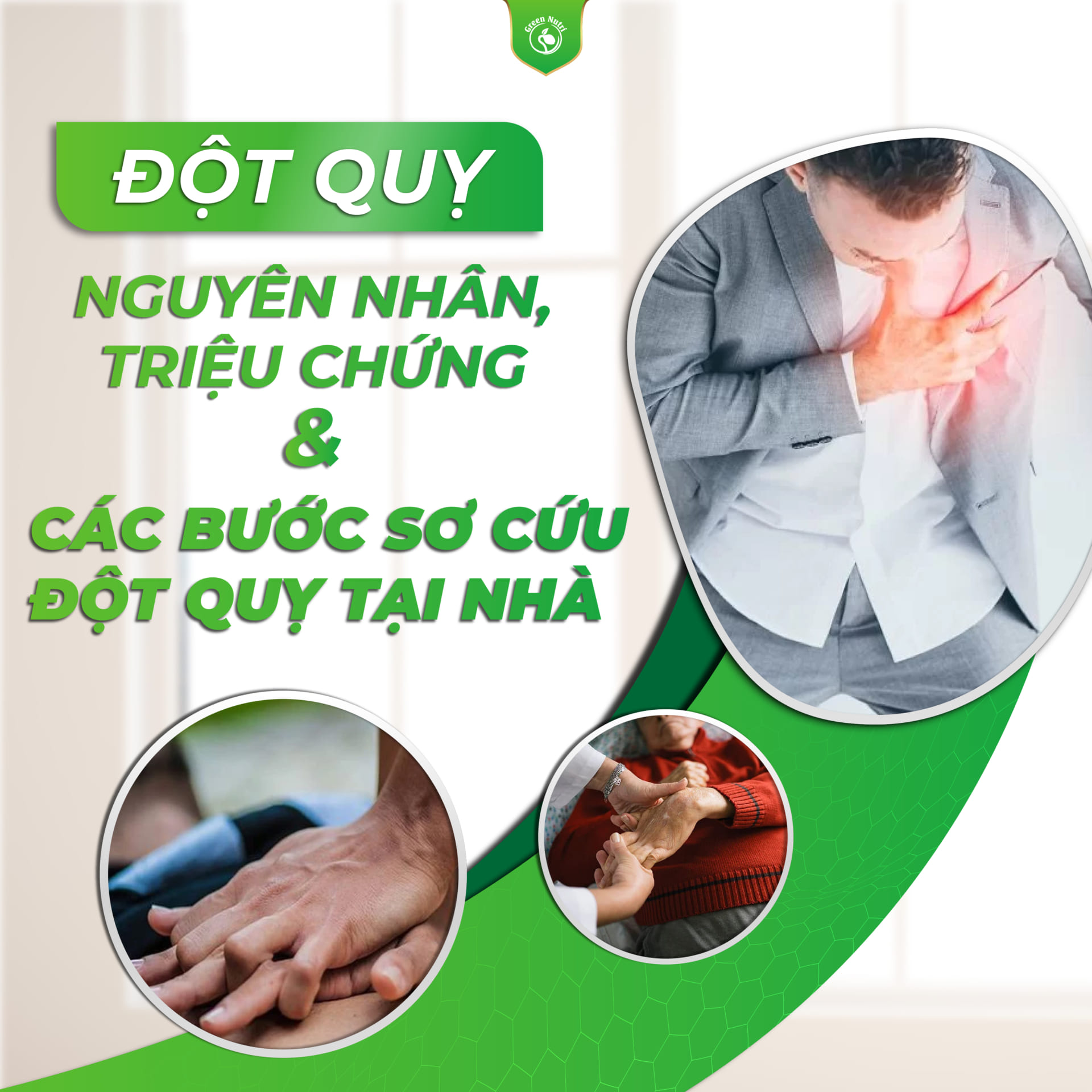 Triệu chứng của đột quỵ, nguyên nhân và cách sơ cứu tại nhà