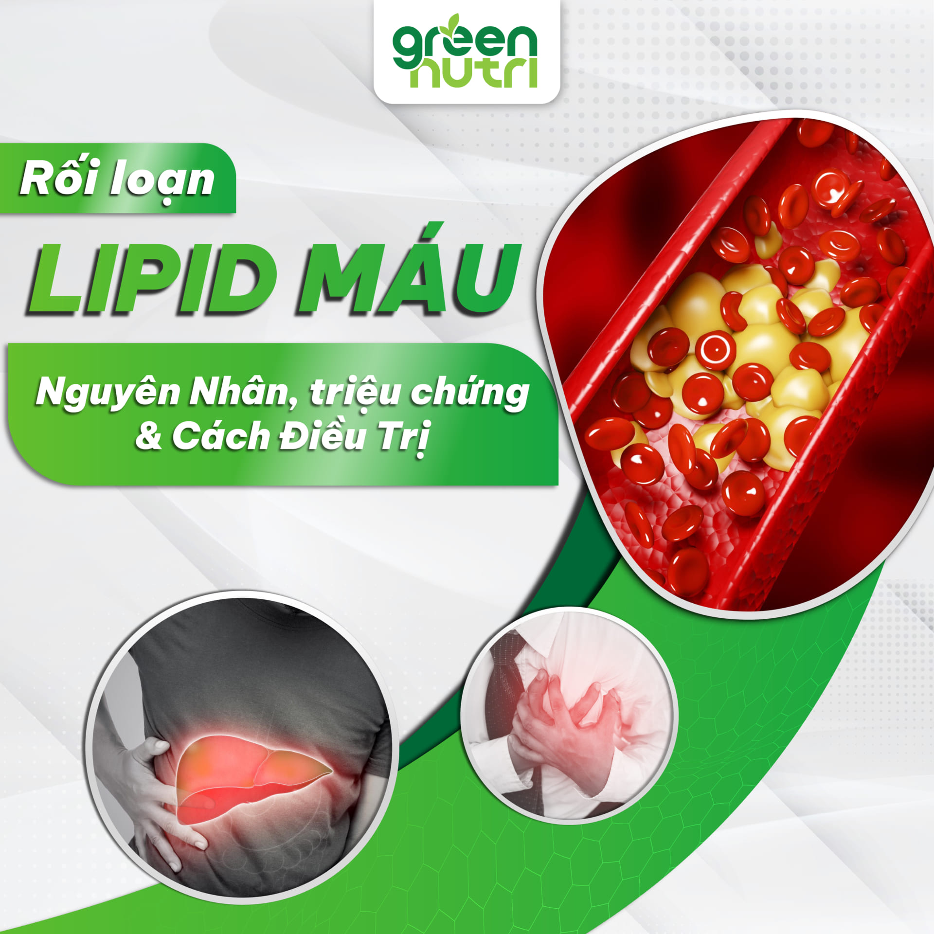 Rối loạn lipid máu (mỡ máu cao) là gì? Nguyên nhân, triệu chứng và cách điều trị